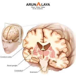 Progressive Supranuclear Palsy