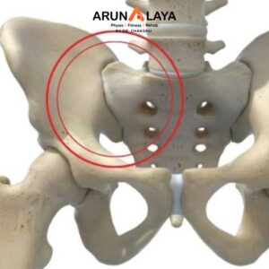 sacroiliac joint syndrome treatment and cure