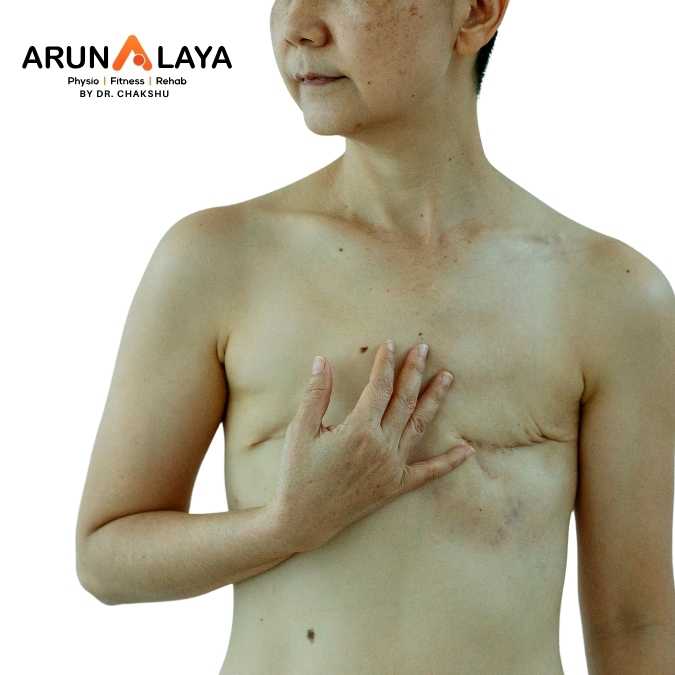 scars tissues treatment and cure