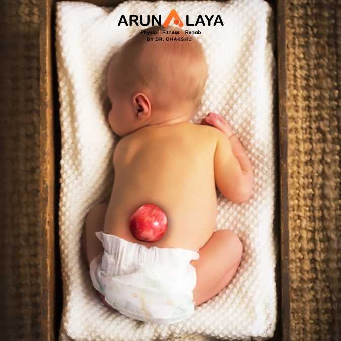 spina bifida treatment and cure