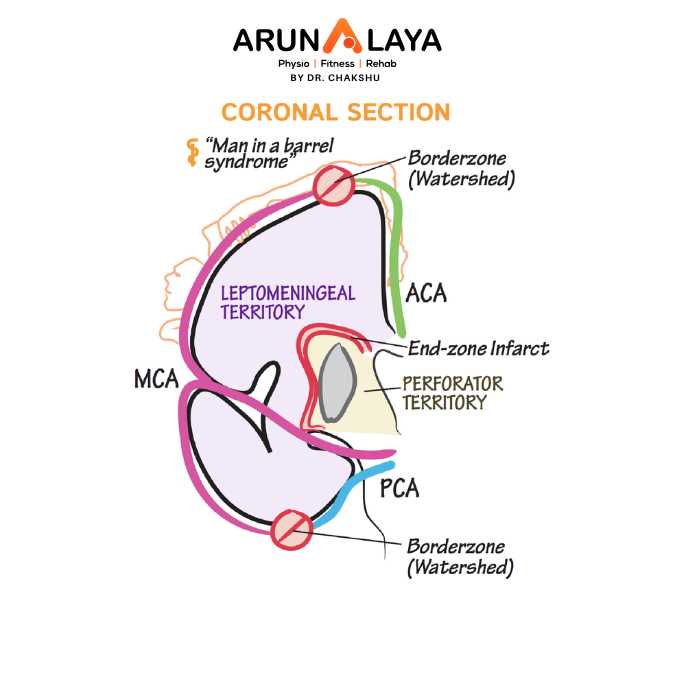 watershed stroke treatment and cure