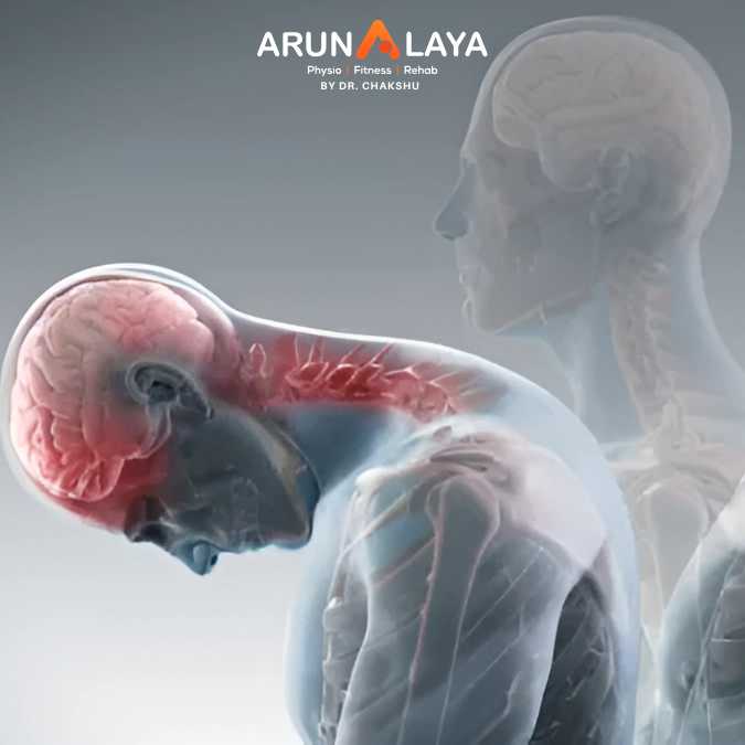 whiplash associated disorder treatment and cure