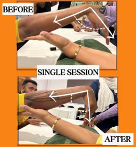 sports injury treatment in delhi