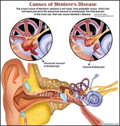 pysiotherapy treatment