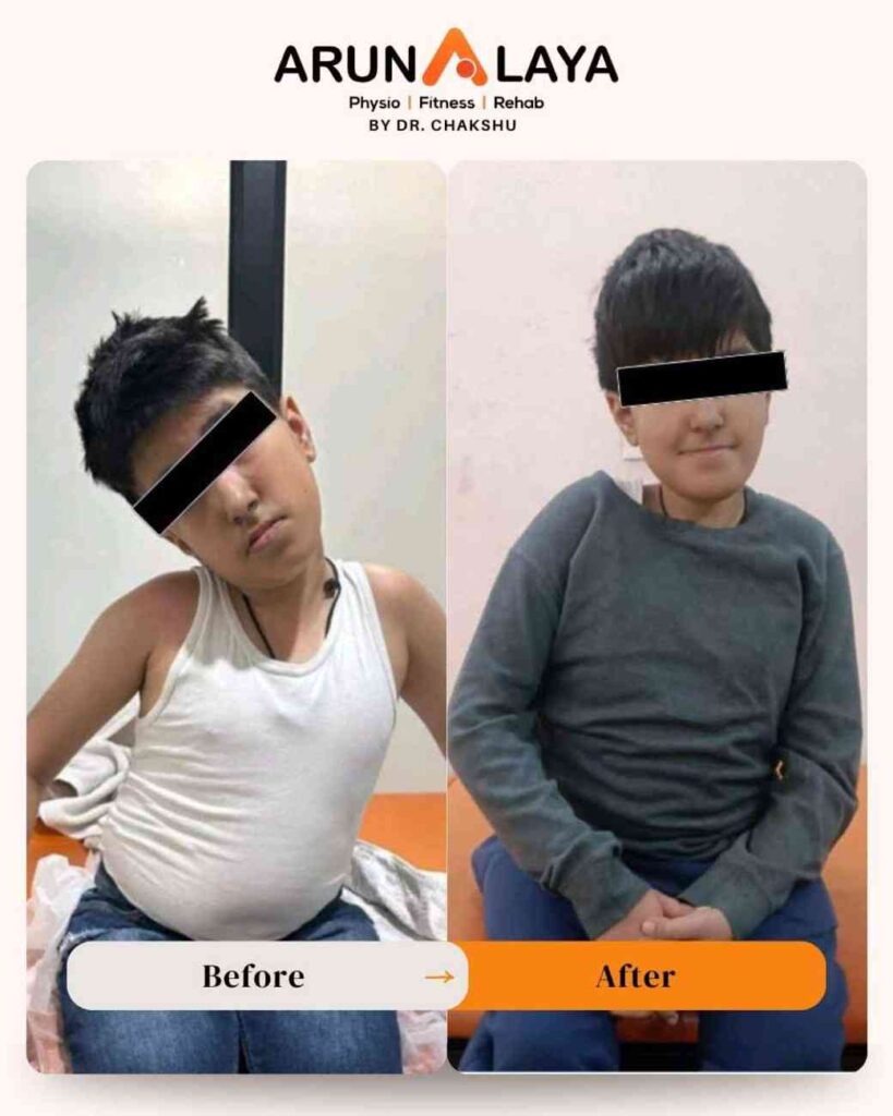 physiotherapist therapy