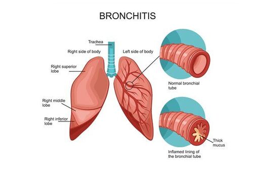 at home physiotherapist