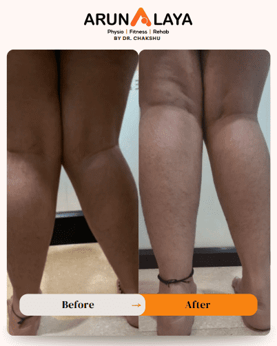 knee pain and treatments