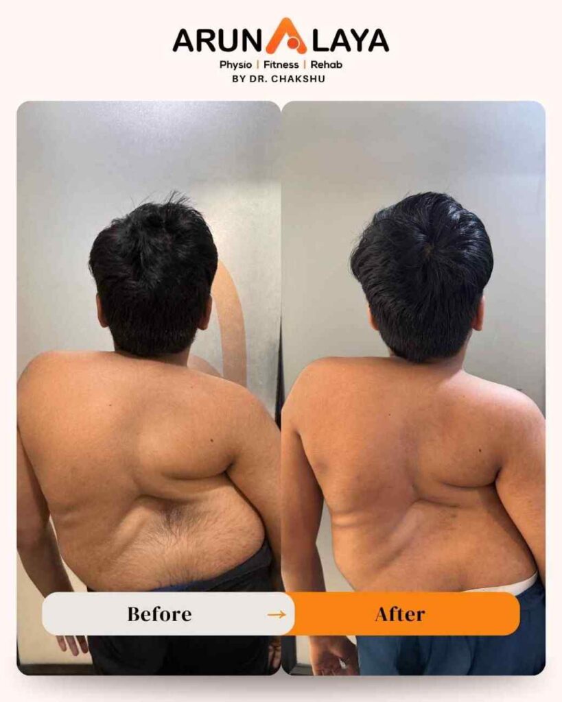 physiotherapy clinic in delhi ncr