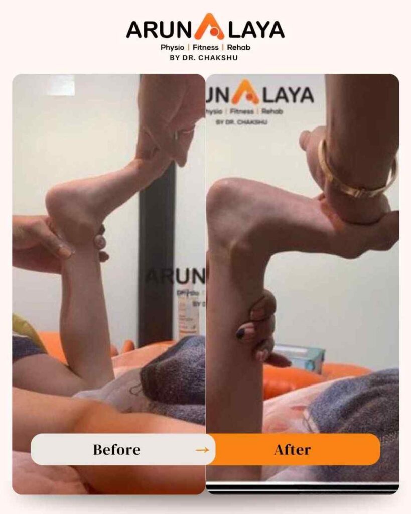 at home physiotherapist