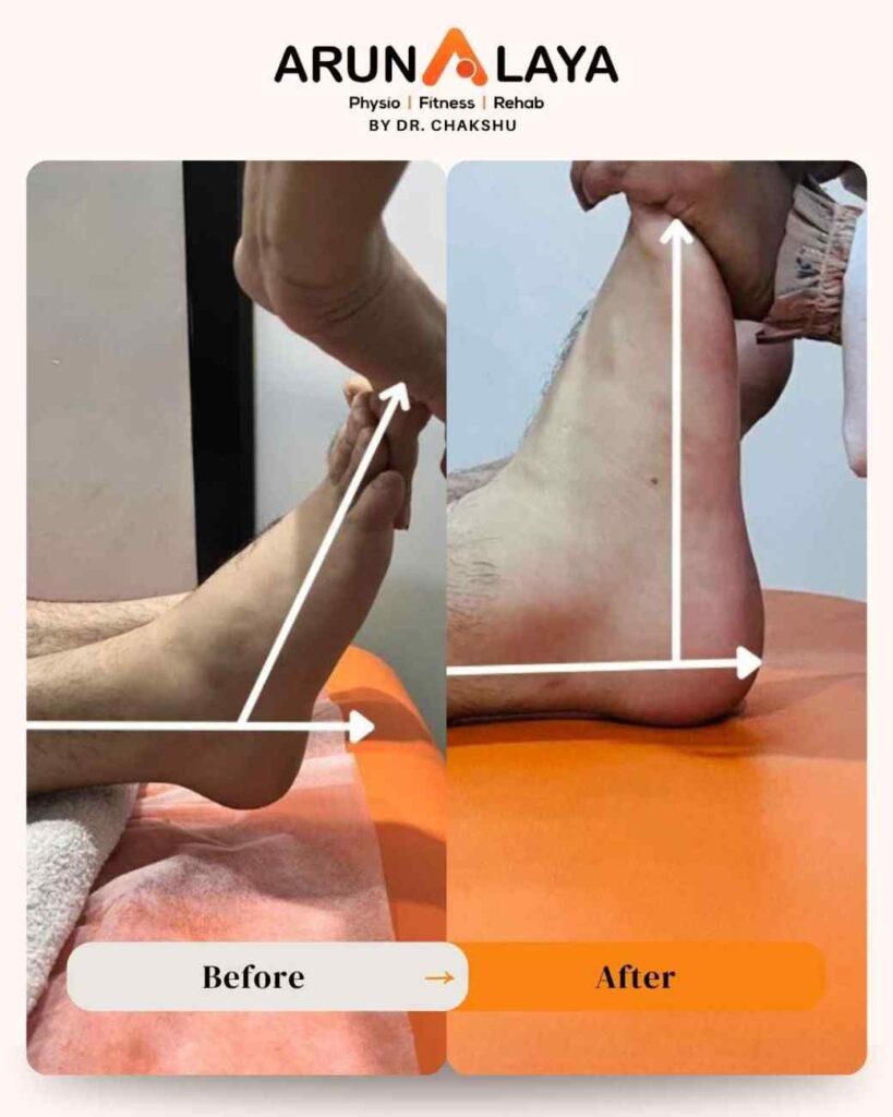 physiotherapy clinic in delhi ncr