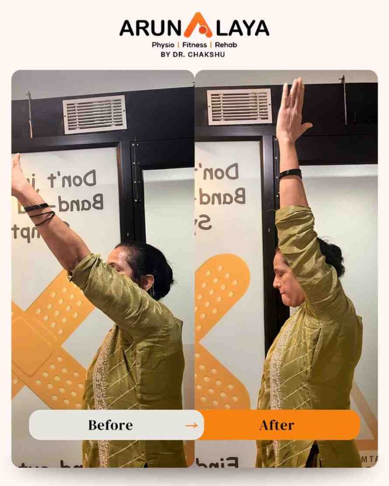 at home physiotherapist