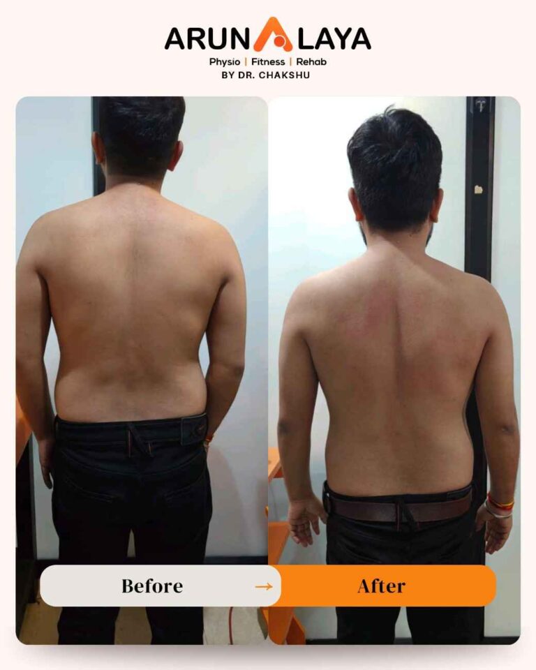 physiotherapist machine