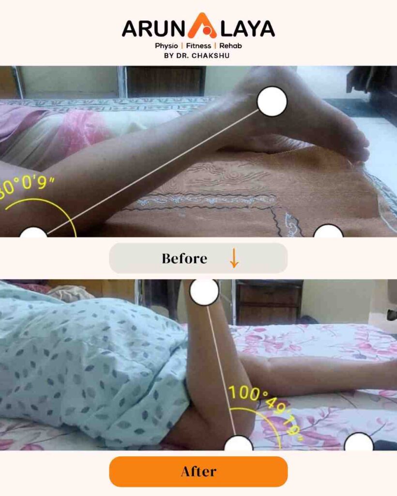 CopyofCopyofbeforeafterpostsnew1080x1350px1_page-0110