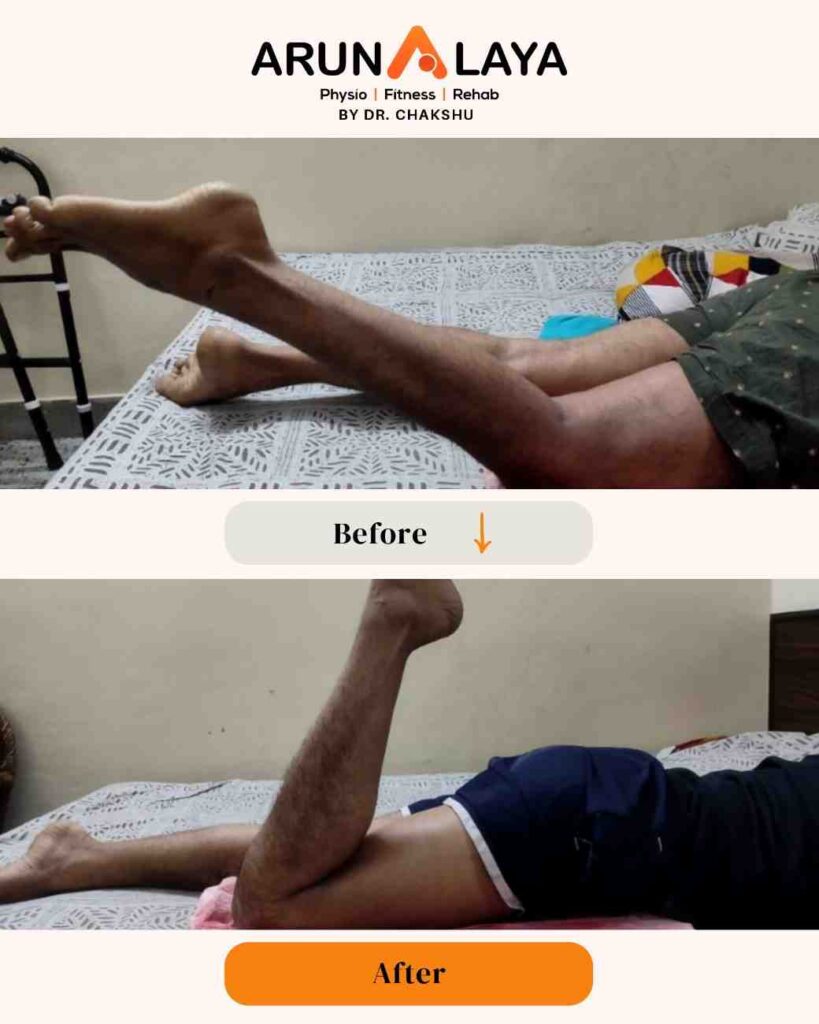 CopyofCopyofbeforeafterpostsnew1080x1350px1_page-0116