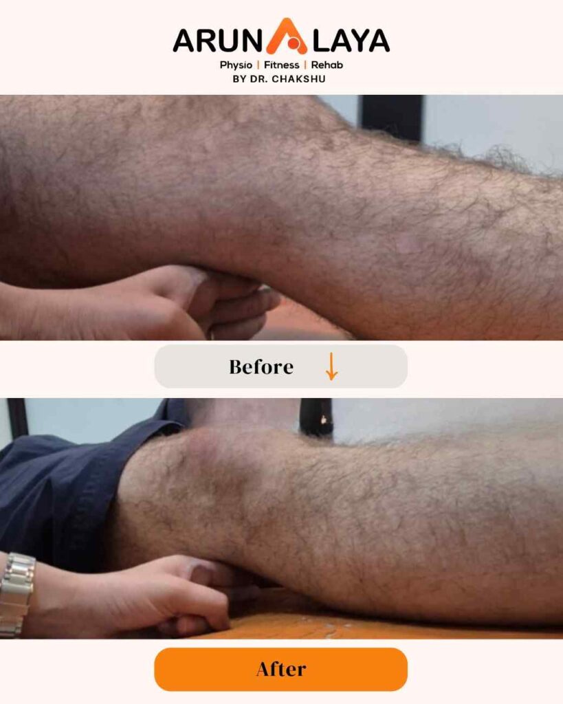 CopyofCopyofbeforeafterpostsnew1080x1350px1_page-0118