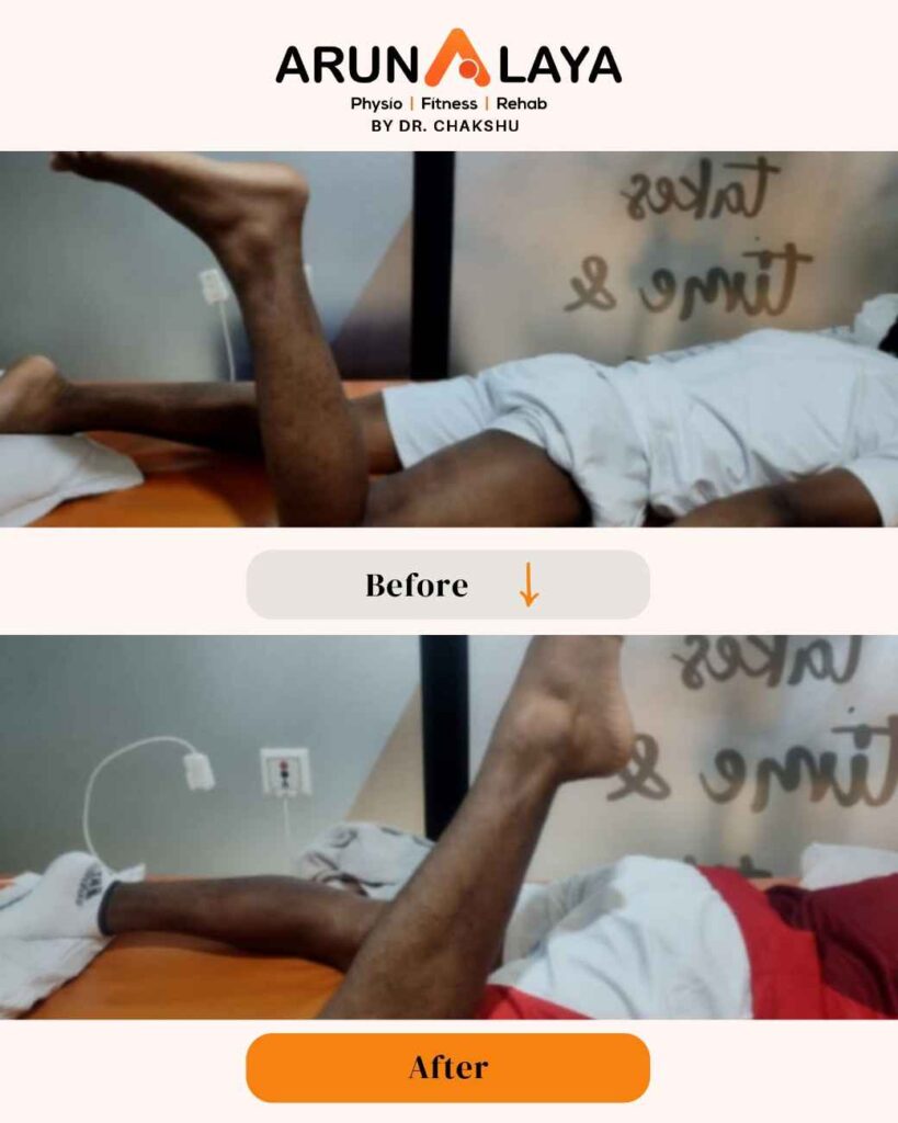 CopyofCopyofbeforeafterpostsnew1080x1350px1_page-0120