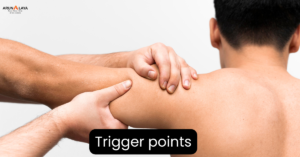 Trigger points