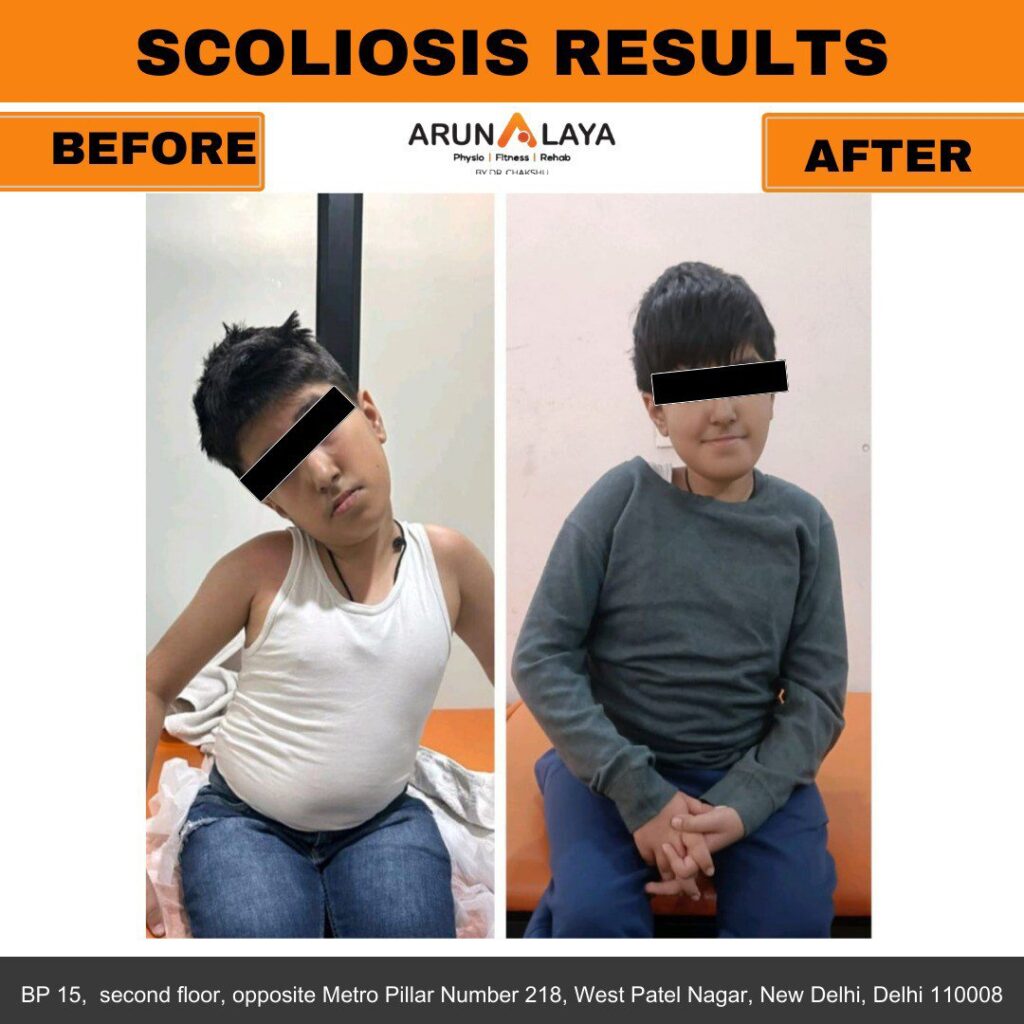 before after treatment pdf-images-0