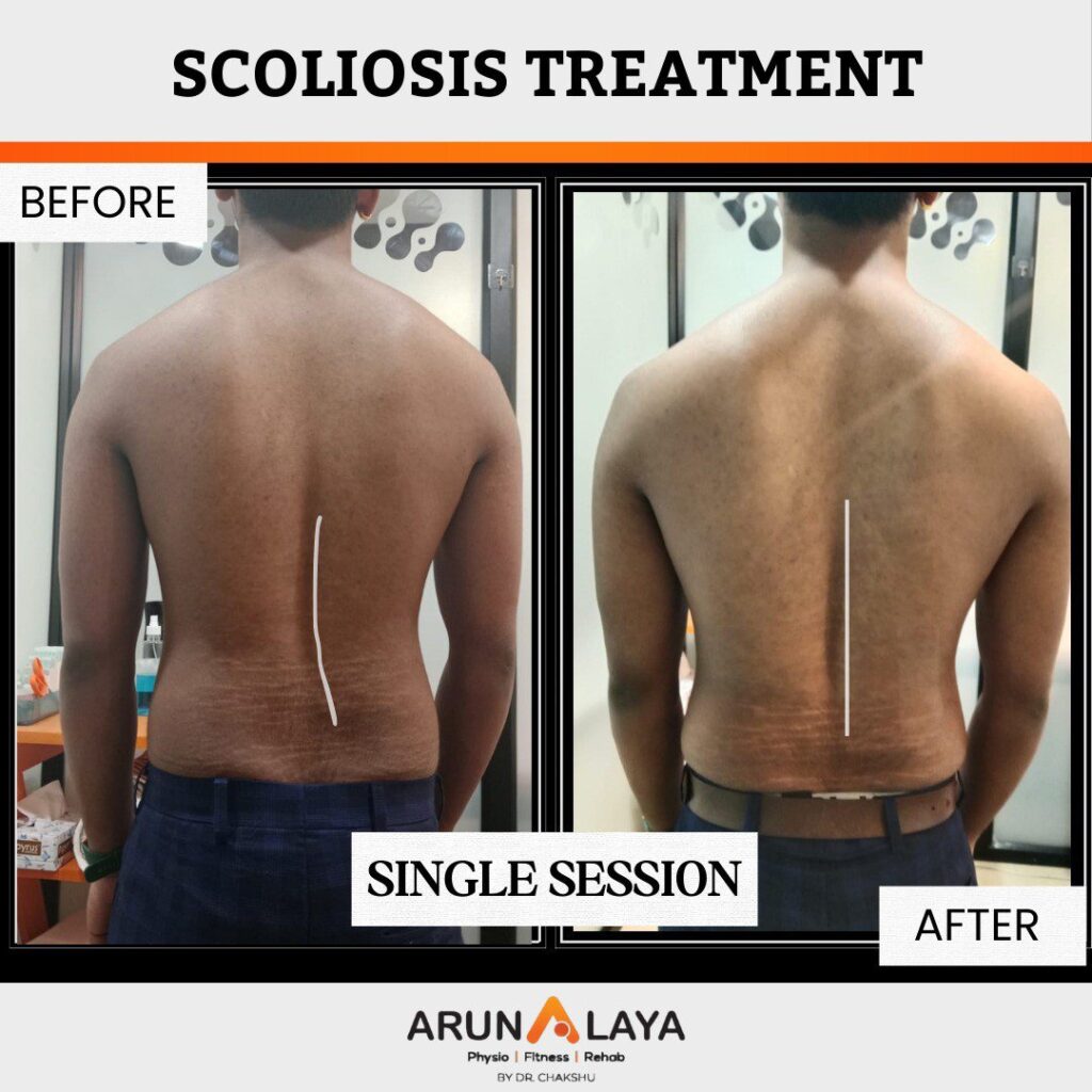 before after treatment pdf-images-40