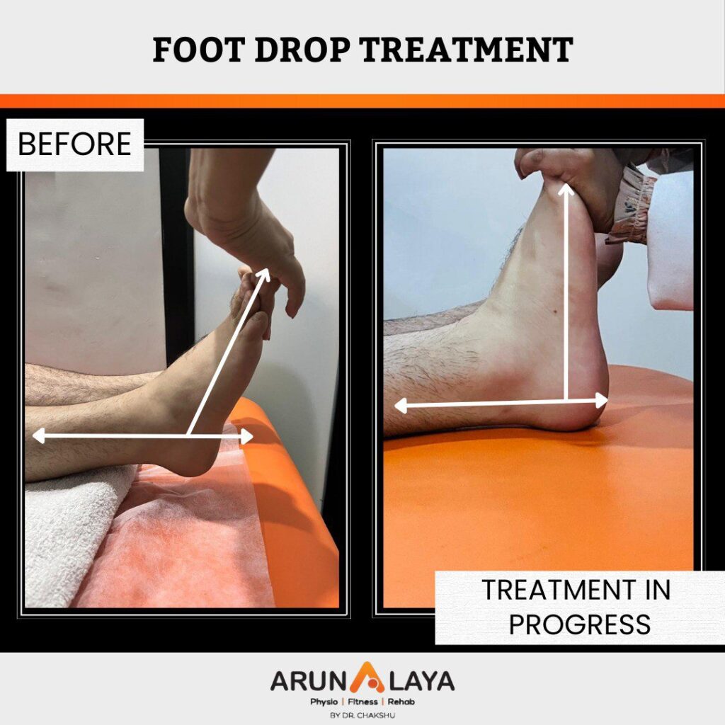 before after treatment pdf-images-51