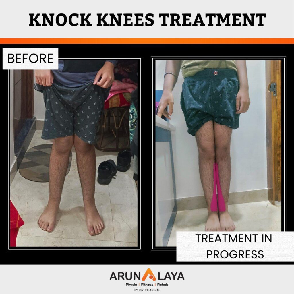 before after treatment pdf-images-55