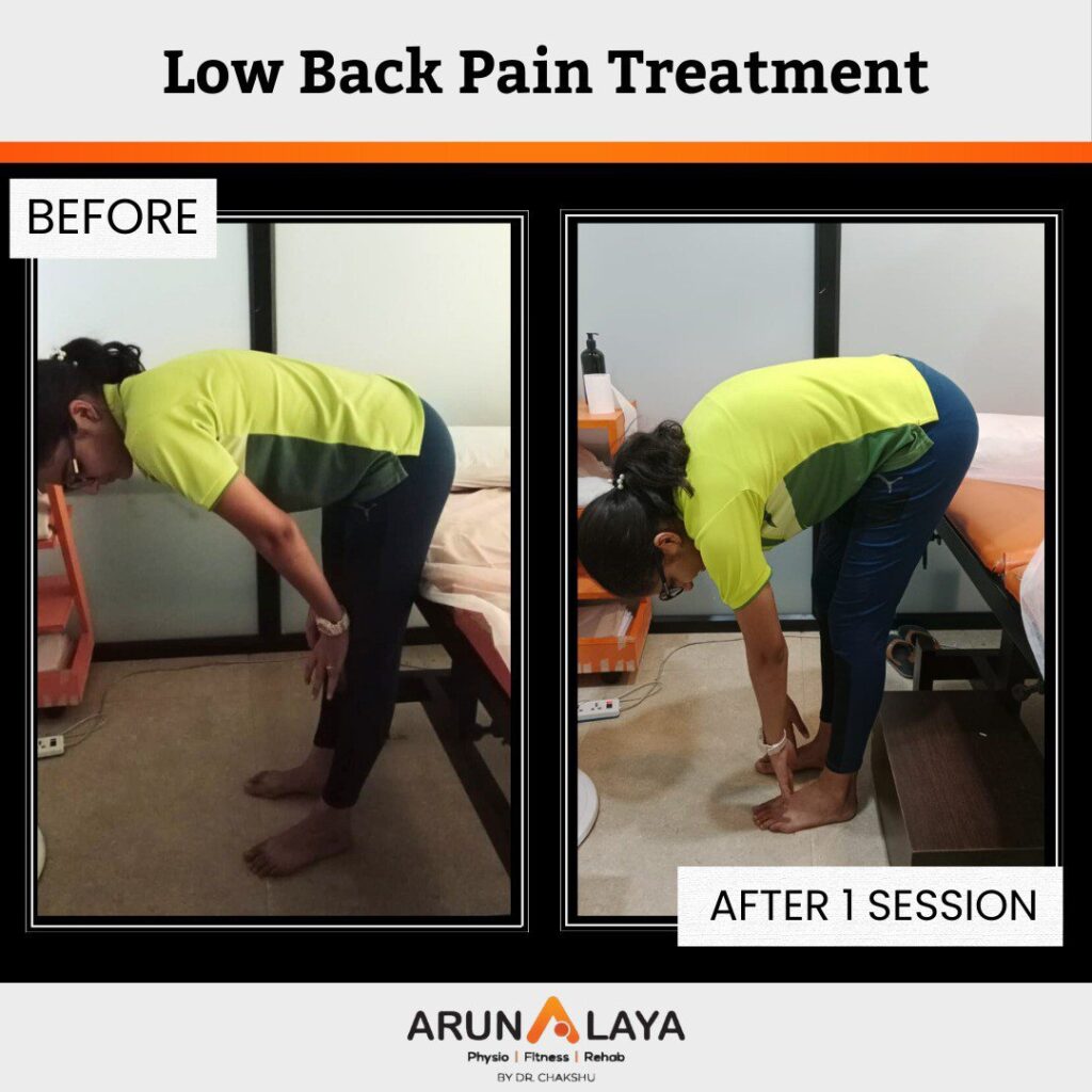 before after treatment pdf-images-6