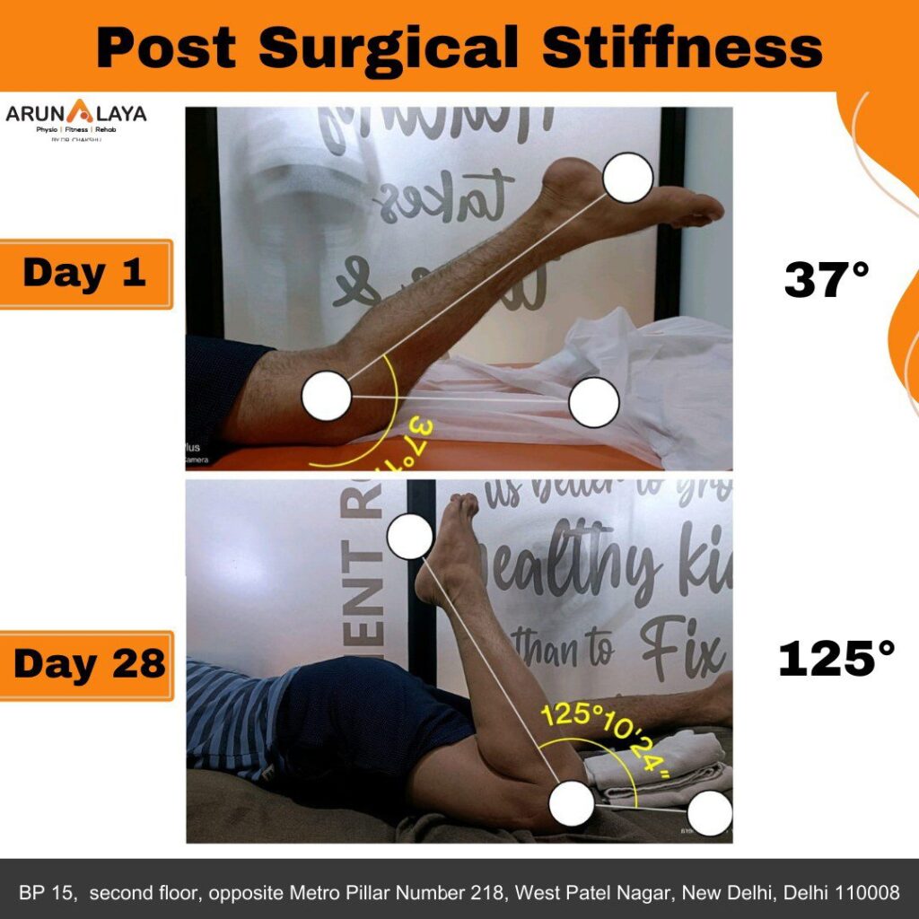 before after treatment pdf-images-69