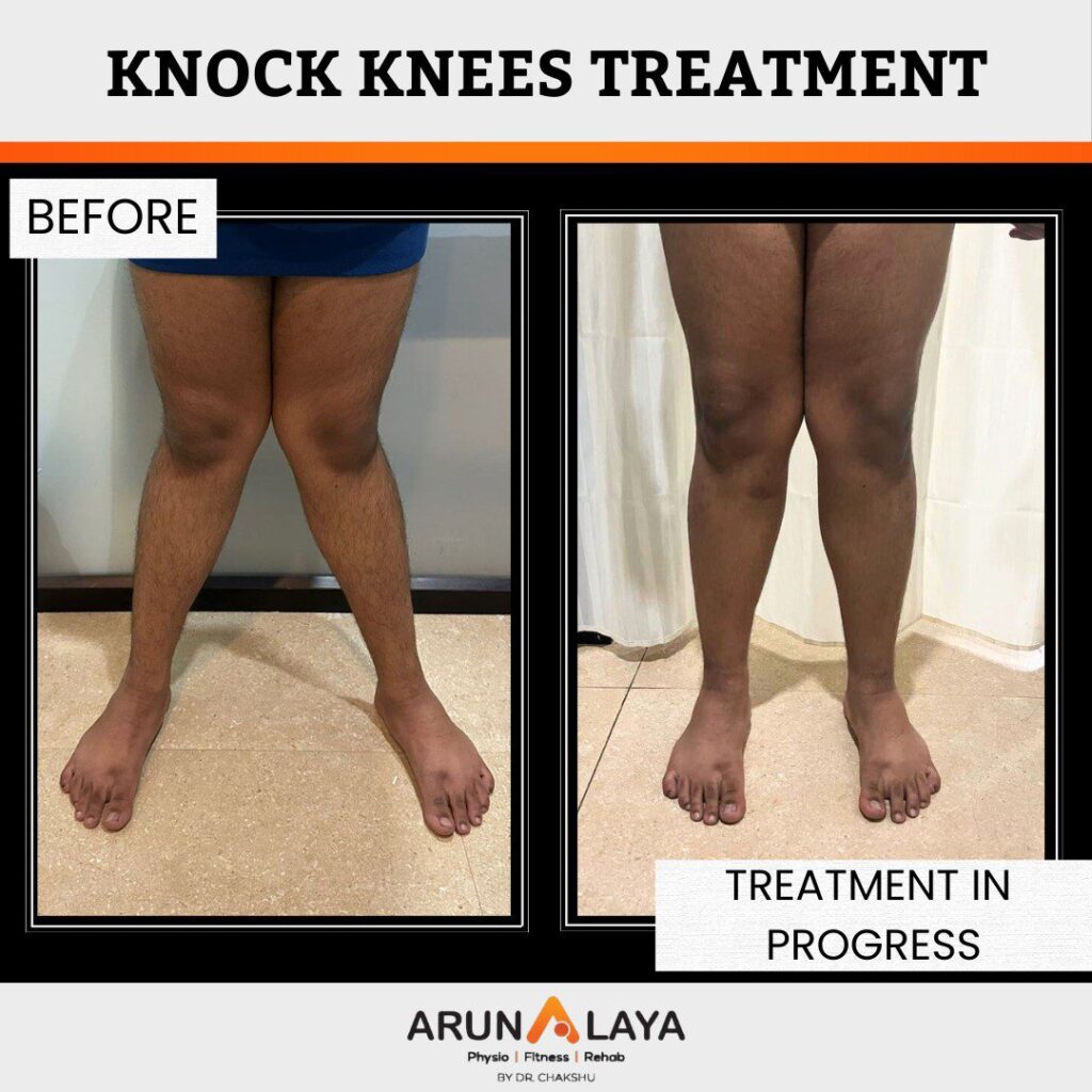 before after treatment pdf-images-9