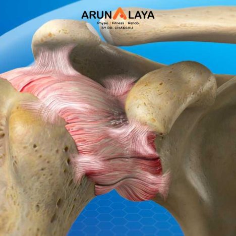adhesive capsulitis treatment and cure